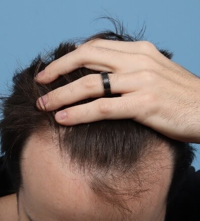 Before Image