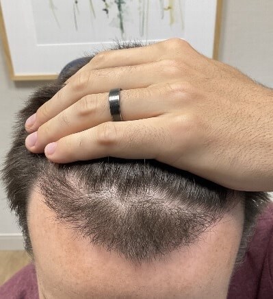 After Image
