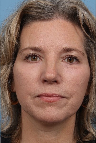 After Image
