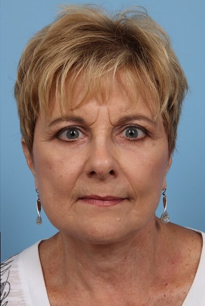 After Image