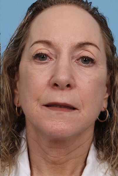 After Image