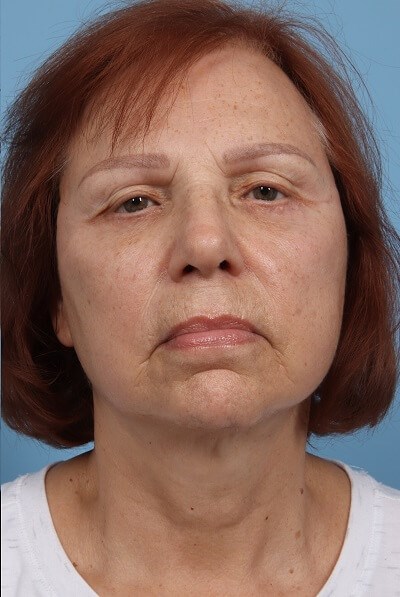 After Image