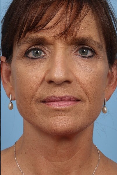 After Image