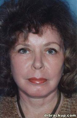 After Image