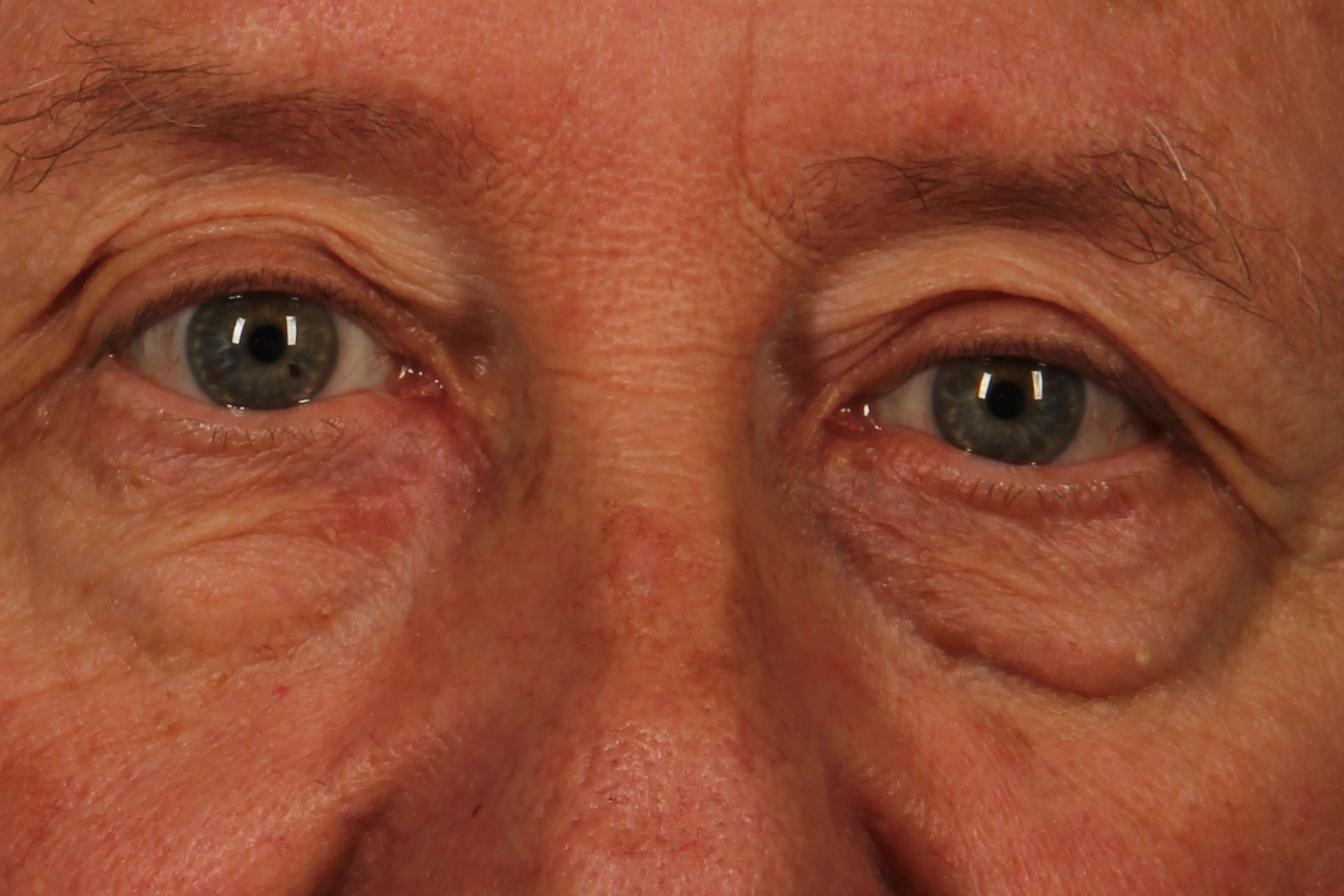 Before Image