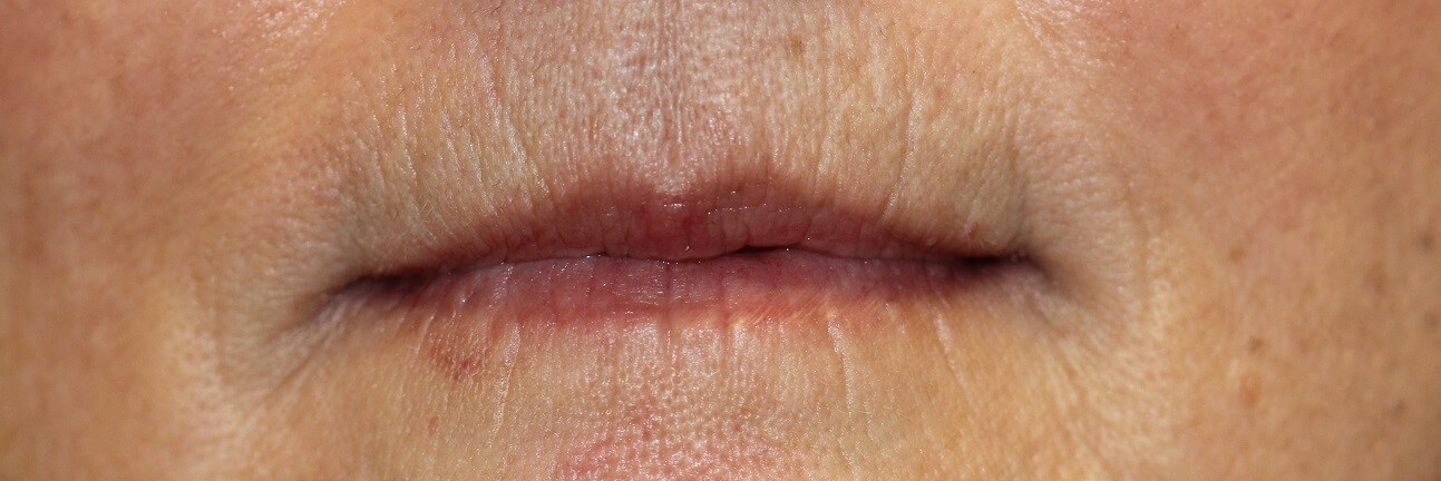 Before Image