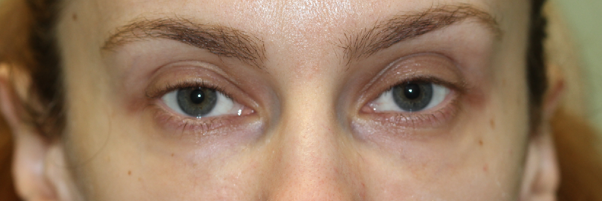 After Image