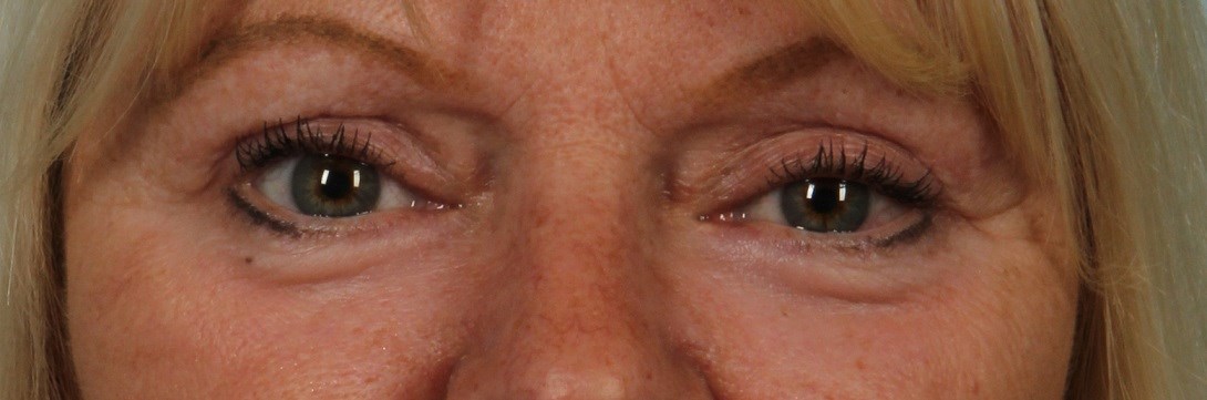 After Image