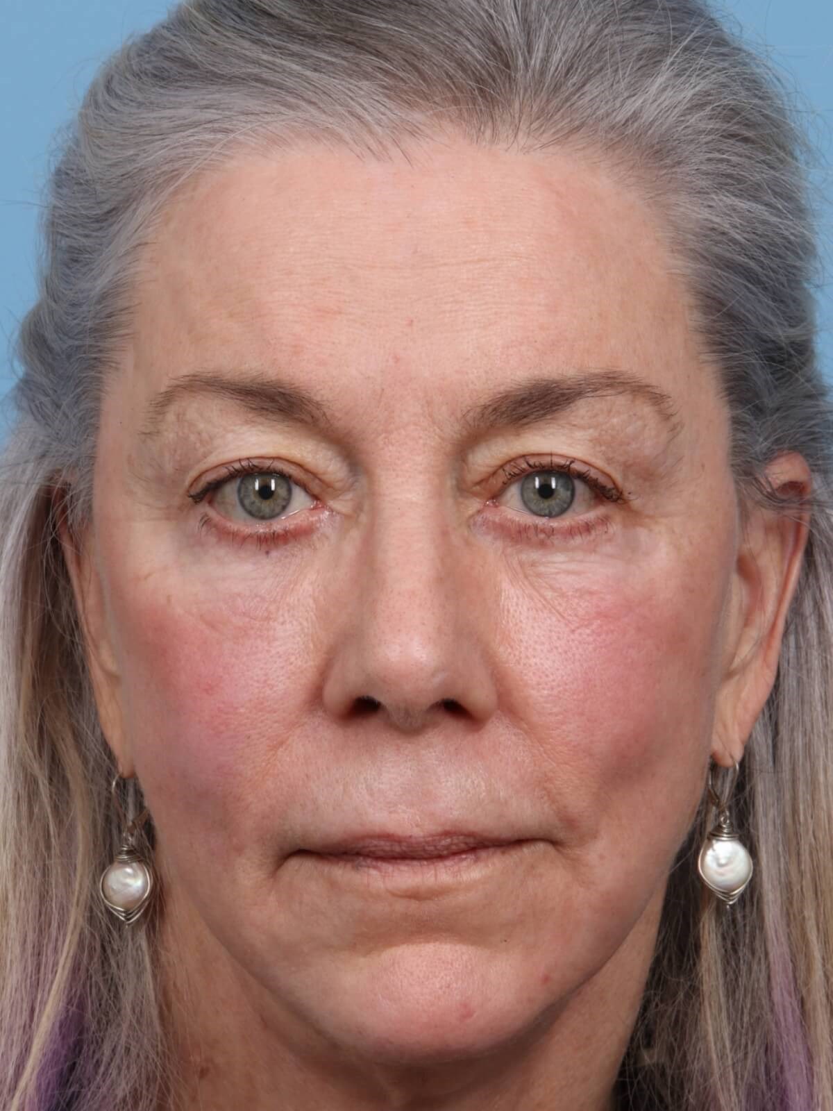 After Image
