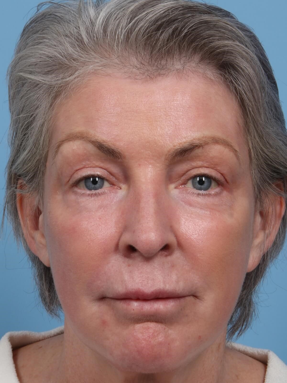 After Image