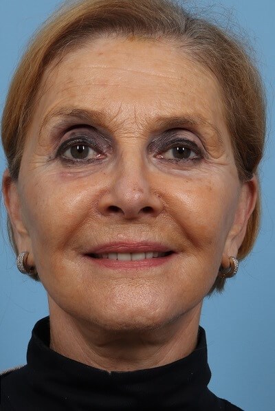 After Image