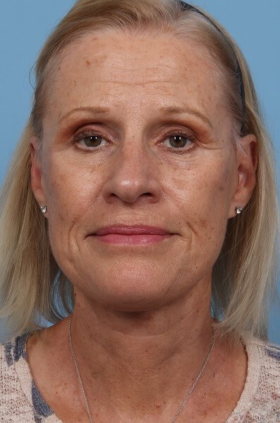 After Image