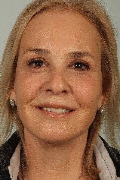 After Image