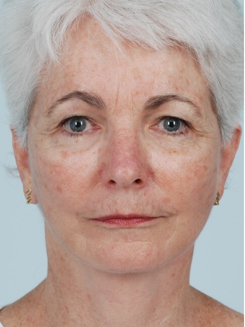 After Image