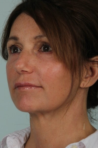 After Image