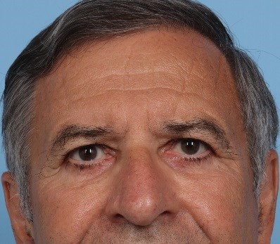 After Image