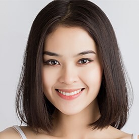 IPL Photofacial